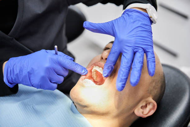 Best Emergency Dental Care for Broken or Chipped Teeth in Martins Additions, MD
